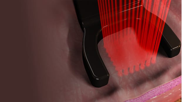 Bio-Stimulation & Lasers : la science derrière l’Harmonie Bio-Boost Bio-Stimulation & Lasers : la science derrière l’Harmonie Bio-Boost