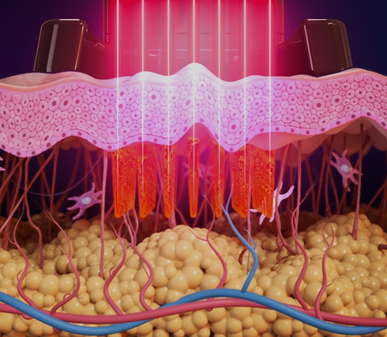 Les rôles du collagène et de l’élastine Les rôles du collagène et de l’élastine